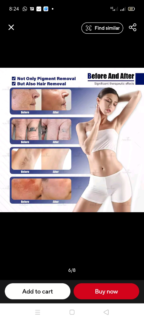 Máquina más reciente de eliminación de tatuajes con picosegundos 4Waves Pico Q-Switch Nd Yag Pigmentación Carbono ✓634680939212831220