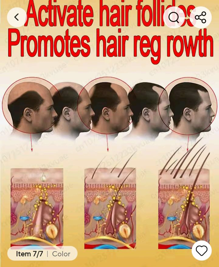 Hair loss treatment Ac63427377243139123