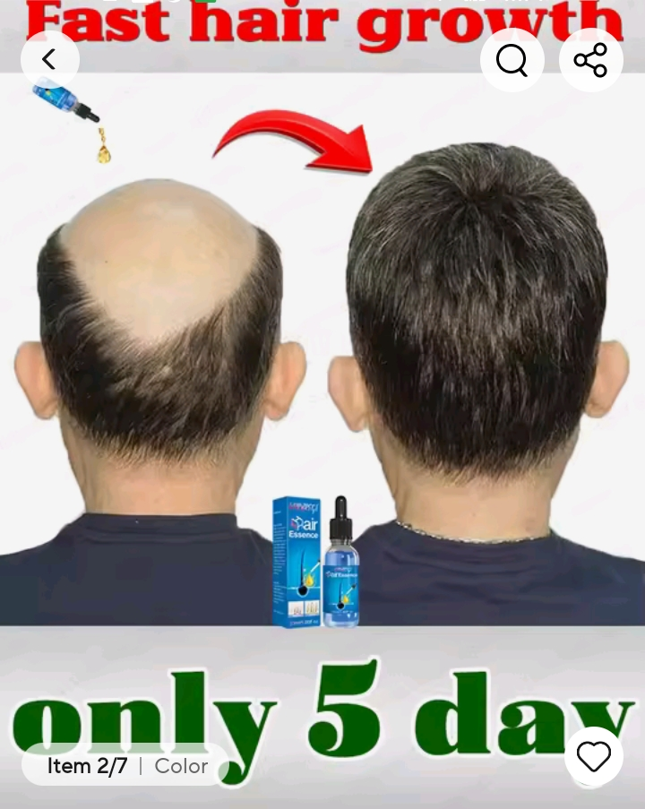 Tratamiento para la pérdida de cabello Ac63427377243139120